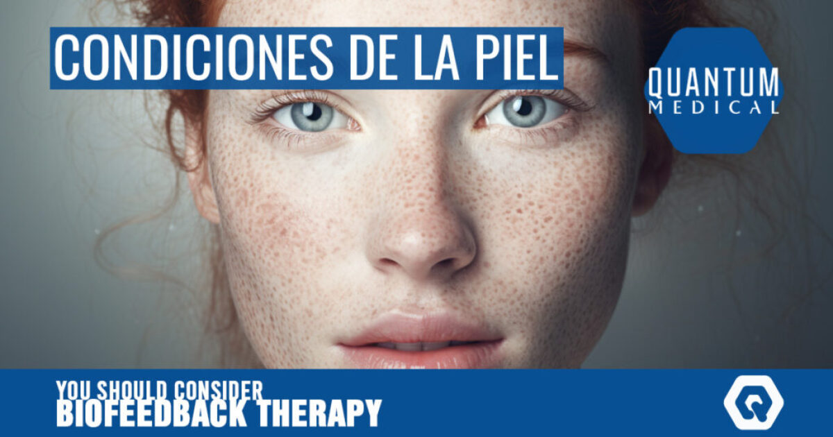 Condiciones de la piel