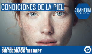 Condiciones de la piel